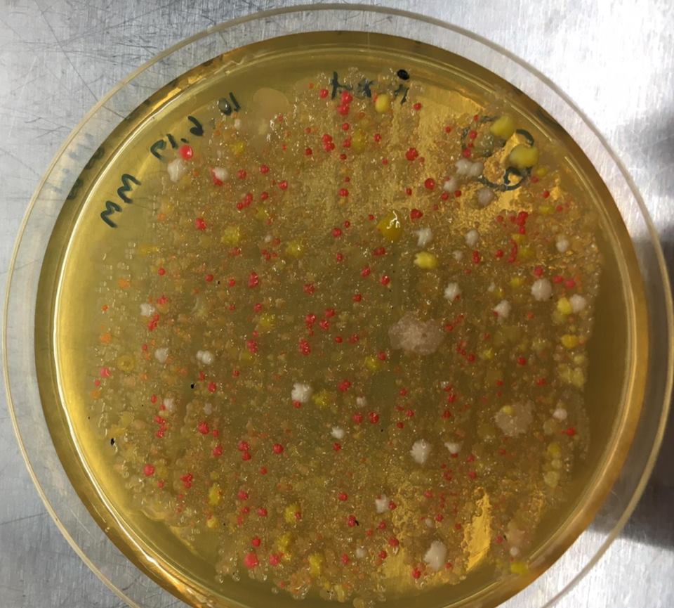 colonie di batteri