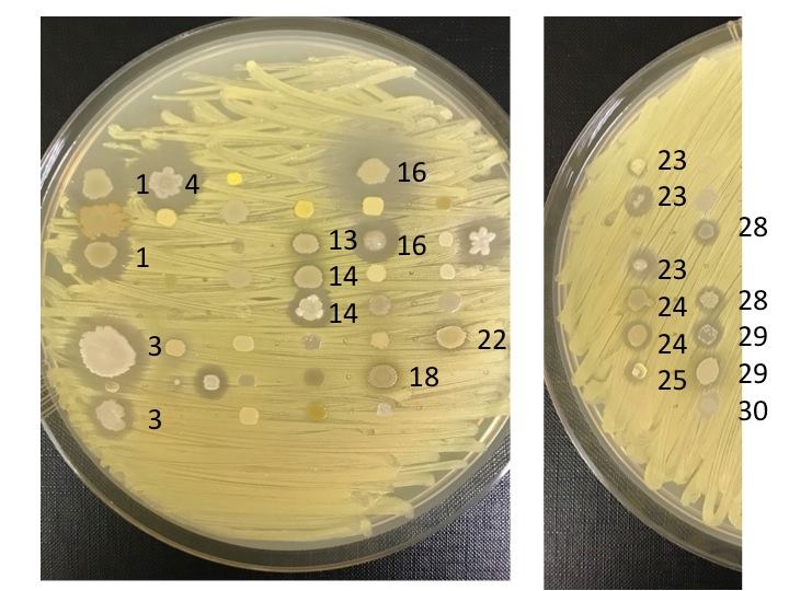 colonie di batteri_3